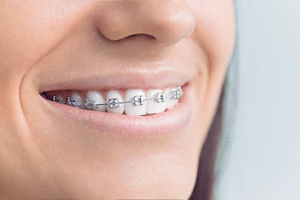 Best Invisalign and Clear Aligners  in Stephenville, TX